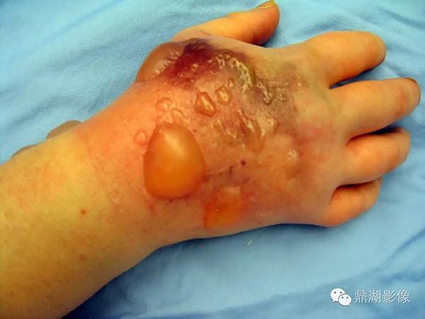 /uploads/image/2022/03/03/4a855fda03a7a835d5d9cc954f0ab6e9.jpg 微信图片_20220303094638.jpg